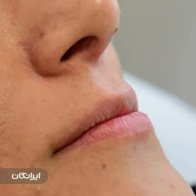 کلینیک زیبایی بینا