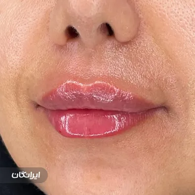 کلینیک زیبایی دکتر محمدرضا خوش آبی