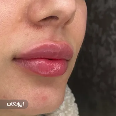 کلینیک زیبایی دکتر محمدرضا خوش آبی