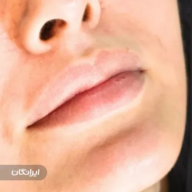 کلینیک زیبایی ایرانمهر