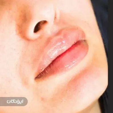 کلینیک زیبایی ایرانمهر