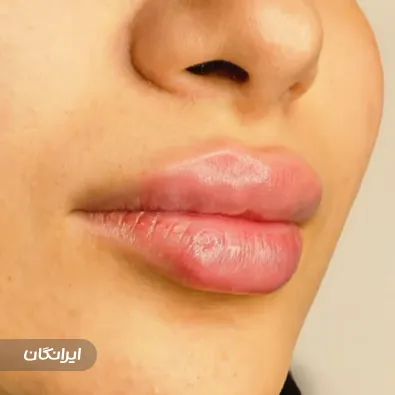 کلینیک زیبایی ایرانمهر