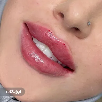 کلینیک زیبایی شکوه