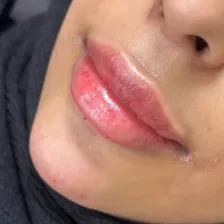 کلینیک زیبایی سینوهه