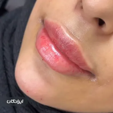 کلینیک زیبایی سینوهه