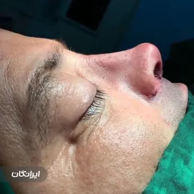 دکتر عیسی عبدی