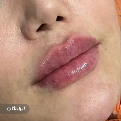 کلینیک زیبایی الماس