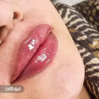 کلینیک زیبایی آروشا