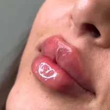 ️کلینیک زیبایی سما