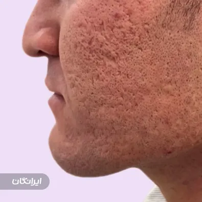 کلینیک زیبایی محیا محبتی