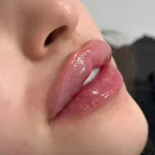 کلینیک زیبایی دیماه