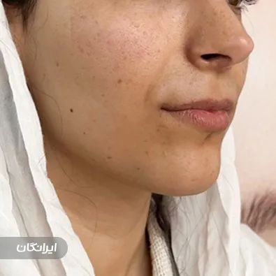 کلینیک زیبایی نویان