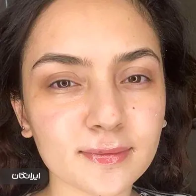 فیشیالیست سارا میراحمدی زاده