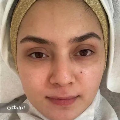 فیشیالیست سارا میراحمدی زاده