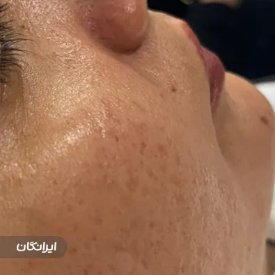 فیشیالیست سارا میراحمدی زاده