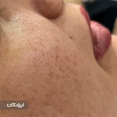 فیشیالیست سارا میراحمدی زاده