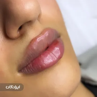 کلینیک زیبایی هورتاش