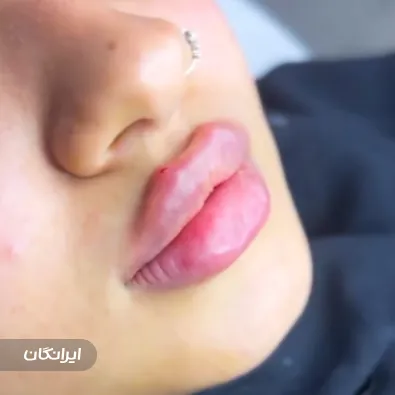 کلینیک زیبایی هورتاش