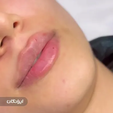 کلینیک زیبایی هورتاش