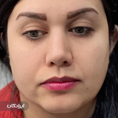 کلینیک زیبایی لیلی