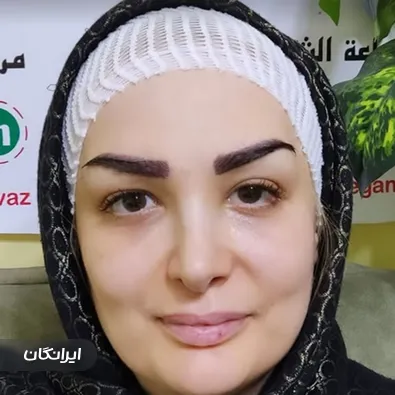 کارشناس کاشت ابرو میرم شیرزادگان