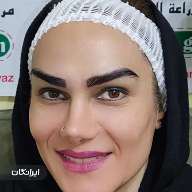 کارشناس کاشت ابرو میرم شیرزادگان