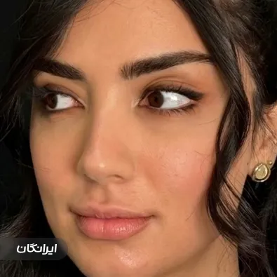 کلینیک زیبایی دکتر آوید فرهنگ