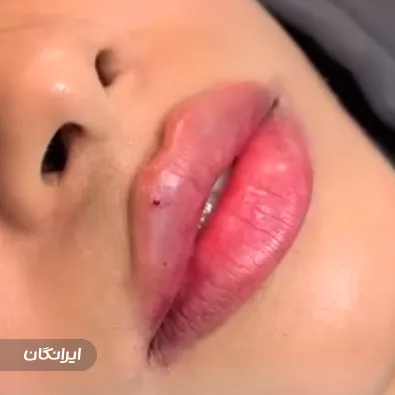 کلینیک زیبایی دکتر آوید فرهنگ