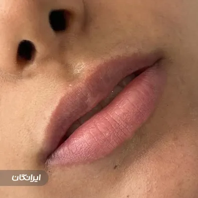 کلینیک زیبایی نگارین