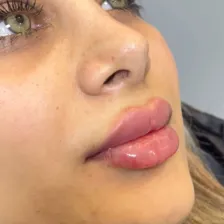 کلینیک زیبایی نگارین