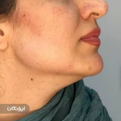 کلینیک زیبایی مه تیام