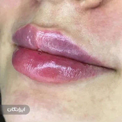 کلینیک زیبایی دکتر آرش خاکی