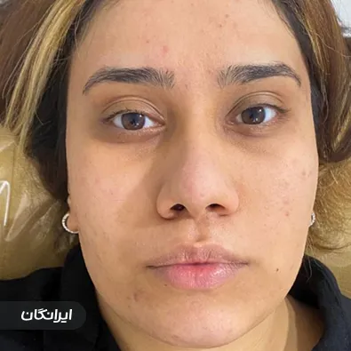 میکاپ آرتیست حدیث شیرالی