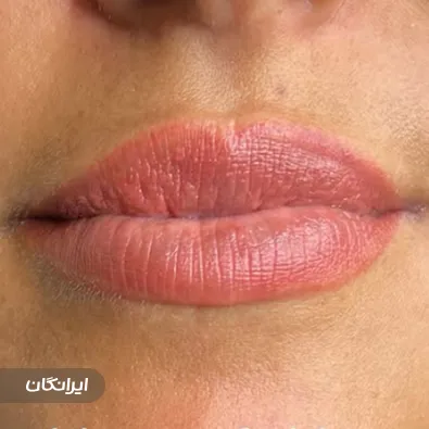 ریموو آرایش دائم خاتون افتخاری