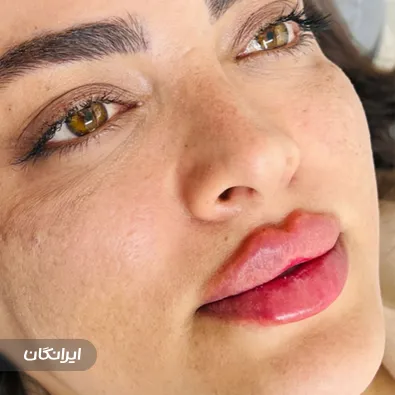 کلینیک زیبایی دکتر مهشید رضایی