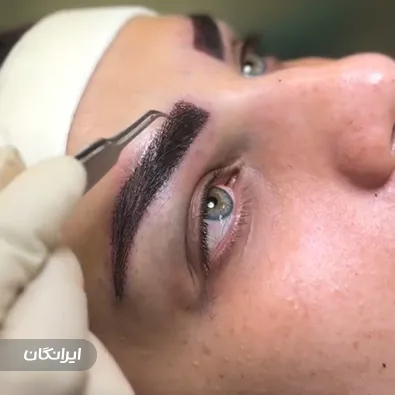 کلینیک کاشت مو رویش