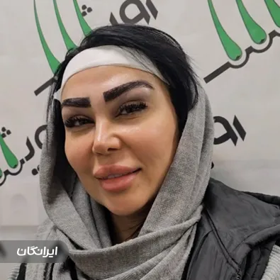 کلینیک کاشت مو رویش