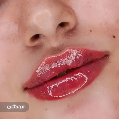 کلینیک زیبایی دکتر زینب بوشهری