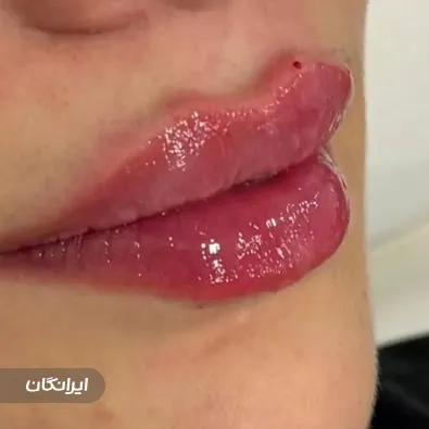 کلینیک زیبایی و لیزر ابراهیمی