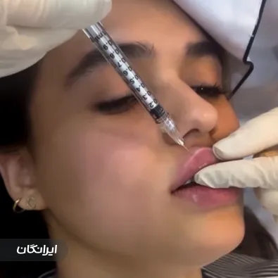 کلینیک زیبایی دیاموند