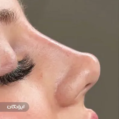 کلینیک زیبایی دکتر فراهانی