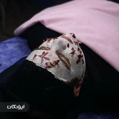 کلینیک زیبایی و لیزر فردیس