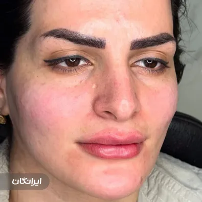 کلینیک زیبایی الیزا