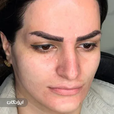 کلینیک زیبایی الیزا