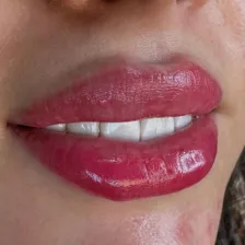 کلینیک زیبایی الیزا