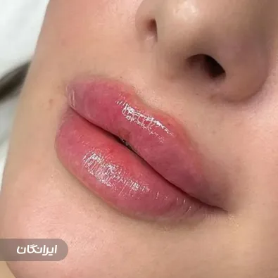 کلینیک زیبایی نسا کرم زاده