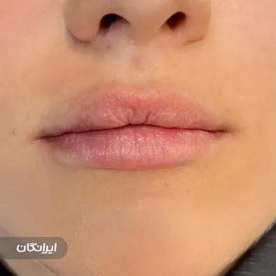 کلینیک زیبایی نسا کرم زاده