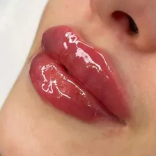 کلینیک زیبایی نسا کرم زاده