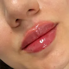 کلینیک زیبایی دکتر شکیبا غلامزاده