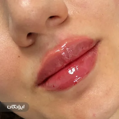 کلینیک زیبایی دکتر شکیبا غلامزاده